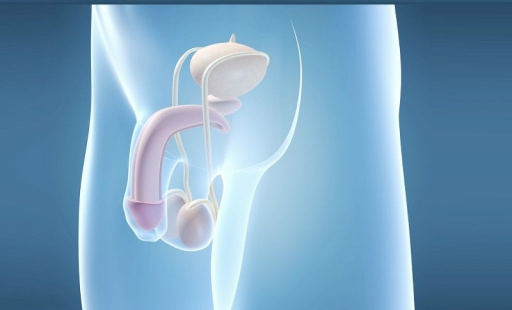 Proteseimplantation er en kirurgisk metode til at forstørre den mandlige penis