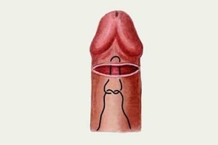 hvordan til at øge penis
